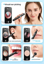 Wireless Ear Wax Removal With Camera Rechargeable Ear Cleaner HD Check Camera with Ear Spoon Set Canal Clean