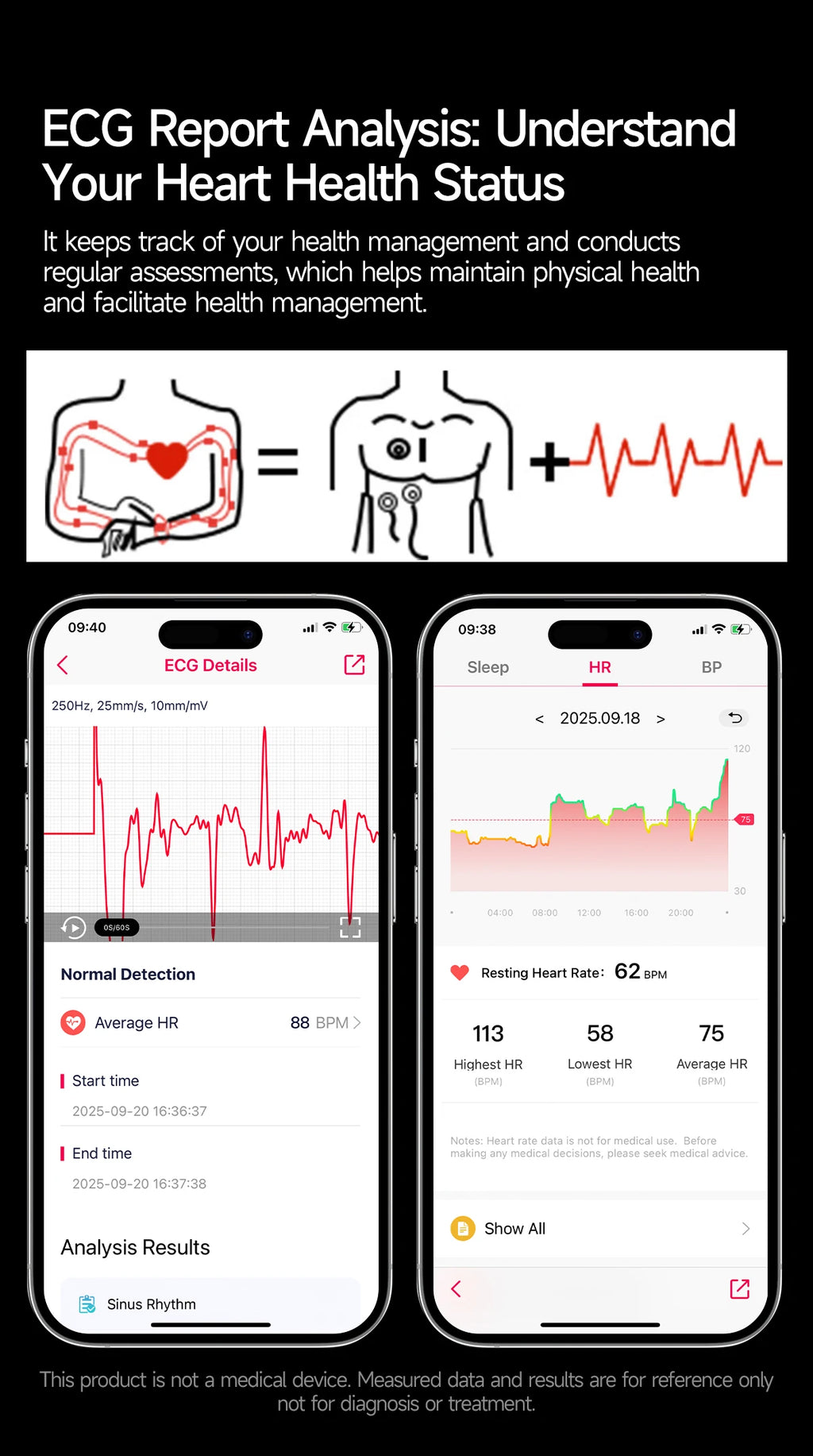 2026 New Accurate Body Health analysis Smart Watch Men ECG Blood lipids Uric acid Blood Pressure Body Fat Voice Call Smartwatch
