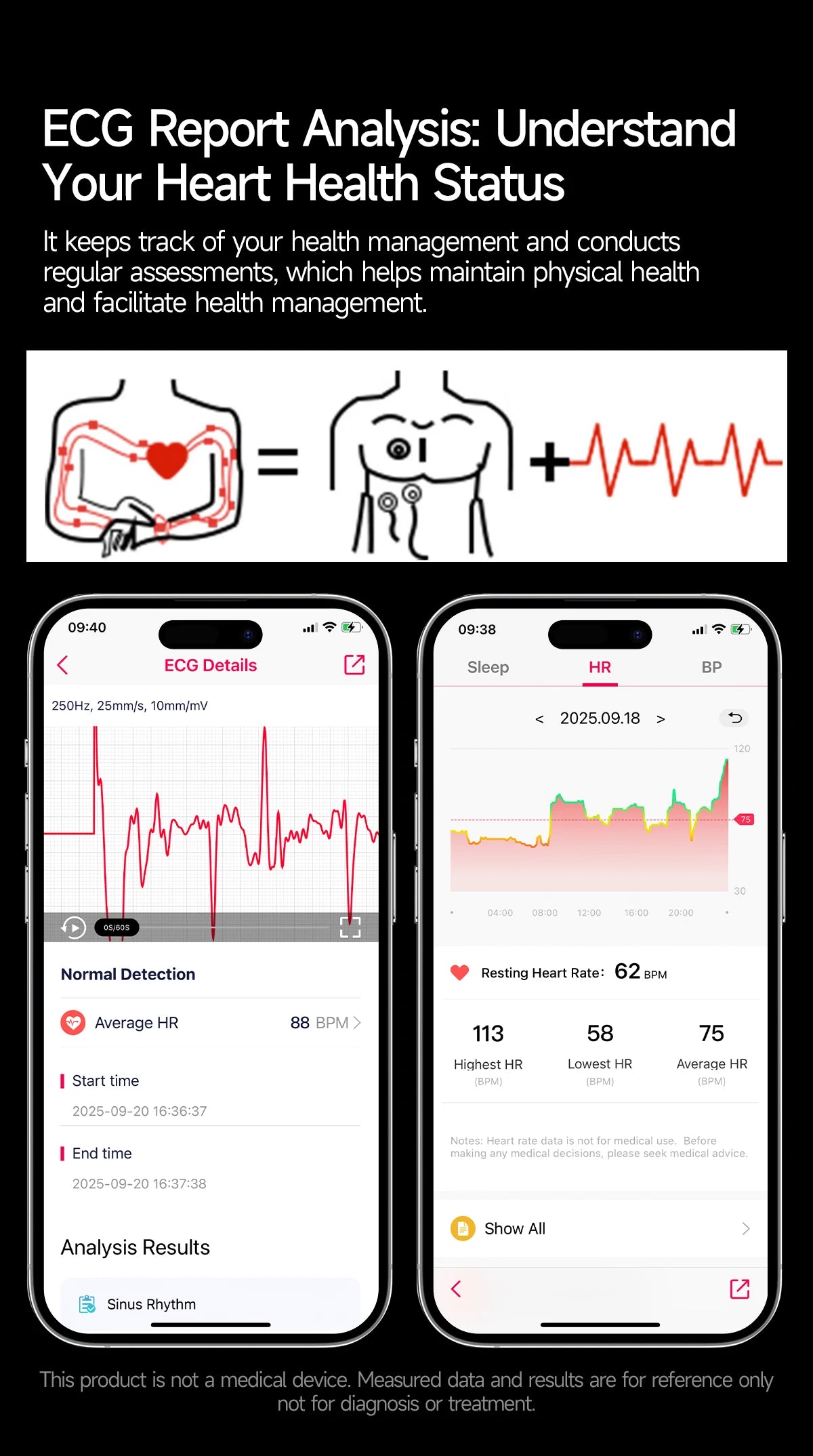 2026 New Accurate Body Health analysis Smart Watch Men ECG Blood lipids Uric acid Blood Pressure Body Fat Voice Call Smartwatch