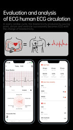 2026 New Nursing Grade ECG+PPG Smart Watch Health Analysis Blood pressure Lipids Uric acid Wireless HD Call Smartwatch Men Women