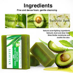 AILKE Aloe Vera Whitening Soap, Remove Acne, Spots, Skin Radiant, Improve Skin Luster, Vegan Bath Wash for All Skin Types, 200g